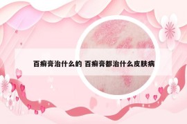 百癣膏治什么的 百癣膏都治什么皮肤病