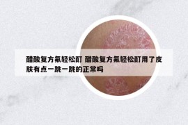 醋酸复方氟轻松酊 醋酸复方氟轻松酊用了皮肤有点一跳一跳的正常吗