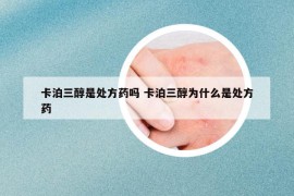 卡泊三醇是处方药吗 卡泊三醇为什么是处方药