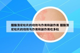 醋酸泼尼松片的功效与作用和副作用 醋酸泼尼松片的功效与作用和副作用吃多粒