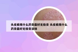 头皮癣用什么药膏最好无极膏 头皮癣用什么药膏最好无极膏涂抹