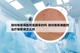 潍坊银屑病医院是国家的吗 潍坊银屑病医院治疗银屑病怎么样