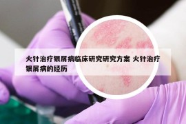 火针治疗银屑病临床研究研究方案 火针治疗银屑病的经历
