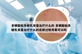多磺酸粘多糖乳膏是治疗什么的 多磺酸粘多糖乳膏是治疗什么的皮肤过敏用着可以吗