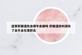 经常肝胆湿热会得牛皮癣吗 肝胆湿热时间长了会不会引发肝炎