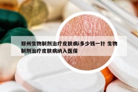 郑州生物制剂治疗皮肤病i多少钱一针 生物制剂治疗皮肤病纳入医保