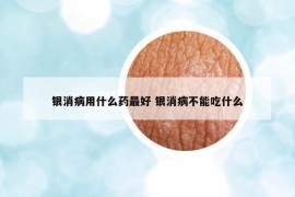 银消病用什么药最好 银消病不能吃什么