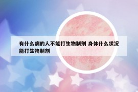 有什么病的人不能打生物制剂 身体什么状况能打生物制剂