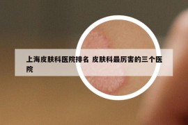 上海皮肤科医院排名 皮肤科最厉害的三个医院