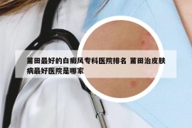 莆田最好的白癜风专科医院排名 莆田治皮肤病最好医院是哪家