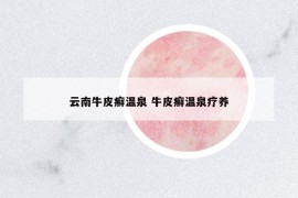 云南牛皮癣温泉 牛皮癣温泉疗养