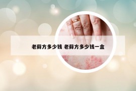 老藓方多少钱 老藓方多少钱一盒