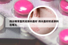 四川哪家医院皮肤科最好 四川最好的皮肤科在哪儿