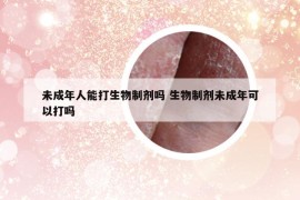 未成年人能打生物制剂吗 生物制剂未成年可以打吗