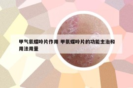 甲气氨蝶呤片作用 甲氨蝶呤片的功能主治和用法用量