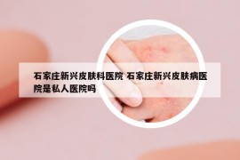 石家庄新兴皮肤科医院 石家庄新兴皮肤病医院是私人医院吗