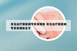 青岛治疗银屑病专家有哪些 青岛治疗银屑病专家有哪些名字