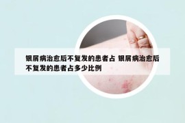 银屑病治愈后不复发的患者占 银屑病治愈后不复发的患者占多少比例