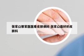 张家口那家医医看皮肤病好 张家口最好的皮肤科