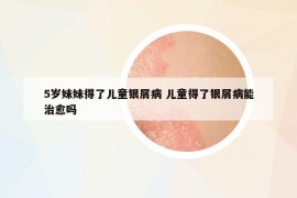 5岁妹妹得了儿童银屑病 儿童得了银屑病能治愈吗