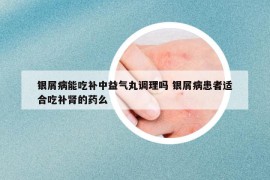 银屑病能吃补中益气丸调理吗 银屑病患者适合吃补肾的药么