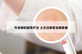 牛皮癣的割耳疗法 土方法割耳治银屑病