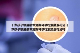 十岁孩子银屑病恢复期可以吃紫菜蛋花汤 十岁孩子银屑病恢复期可以吃紫菜蛋花汤吗