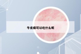 牛皮癣可以吃什么呢