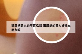 银屑病男人说不喜欢我 银屑病的男人好找女朋友吗