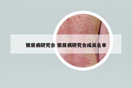 银屑病研究会 银屑病研究会成员名单