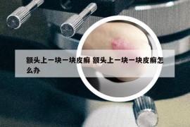 额头上一块一块皮癣 额头上一块一块皮癣怎么办