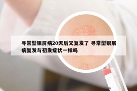 寻常型银屑病20天后又复发了 寻常型银屑病复发与初发症状一样吗