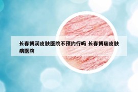 长春博润皮肤医院不预约行吗 长春博瑞皮肤病医院