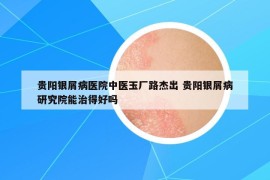 贵阳银屑病医院中医玉厂路杰出 贵阳银屑病研究院能治得好吗