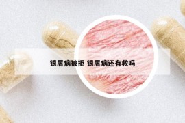 银屑病被拒 银屑病还有救吗