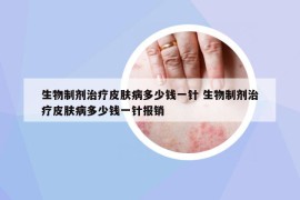 生物制剂治疗皮肤病多少钱一针 生物制剂治疗皮肤病多少钱一针报销