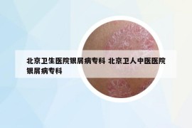 北京卫生医院银屑病专科 北京卫人中医医院银屑病专科
