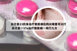 白介素23抗体治疗银屑病在四川哪里可以打 白介素一17a治疗银屑病一周打几次
