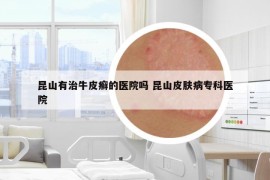 昆山有治牛皮癣的医院吗 昆山皮肤病专科医院