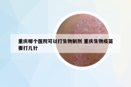 重庆哪个医院可以打生物制剂 重庆生物疫苗要打几针