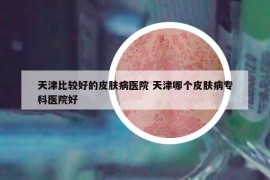 天津比较好的皮肤病医院 天津哪个皮肤病专科医院好