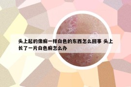 头上起的像癣一样白色的东西怎么回事 头上长了一片白色癣怎么办