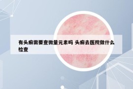 有头癣需要查微量元素吗 头癣去医院做什么检查