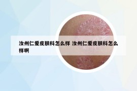 汝州仁爱皮肤科怎么样 汝州仁爱皮肤科怎么样啊