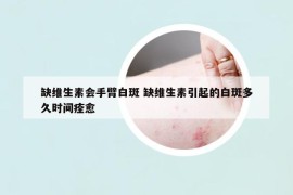 缺维生素会手臂白斑 缺维生素引起的白斑多久时间痊愈