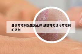 舒银可喷剂效果怎么样 舒银可和适今可喷剂的区别