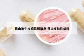 昆山治牛皮癣最新消息 昆山皮肤性病科