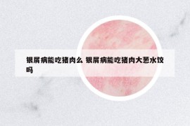 银屑病能吃猪肉么 银屑病能吃猪肉大葱水饺吗
