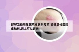 邯郸卫校附属医院皮肤科专家 邯郸卫校医院皮肤科,网上可以咨询