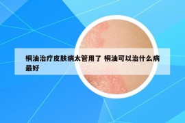 桐油治疗皮肤病太管用了 桐油可以治什么病最好